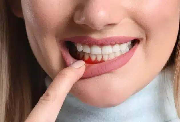 Hidden Importance of Gum Health for Your Smile