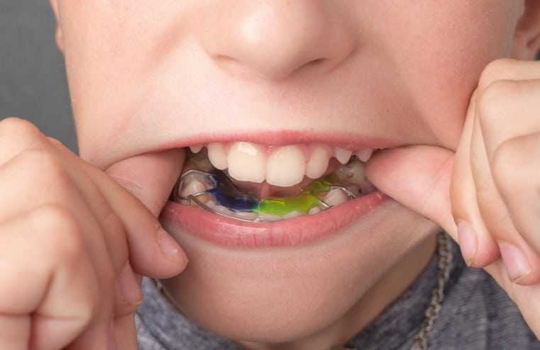 how dentists help alleviate TMJ pain