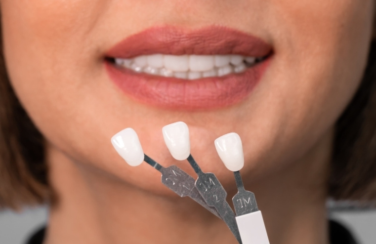how porcelain veneers can handle the demands of an active lifestyle