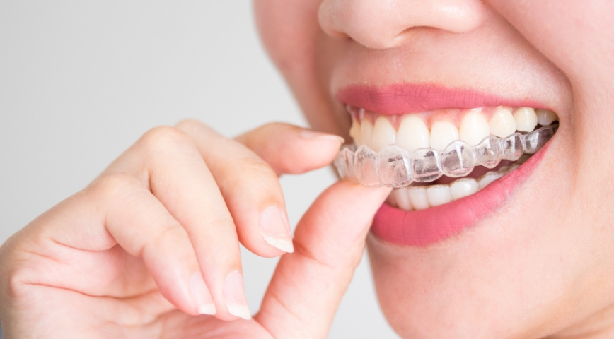 Invisalign Closes Gaps In Teeth And Offers A Better Smile