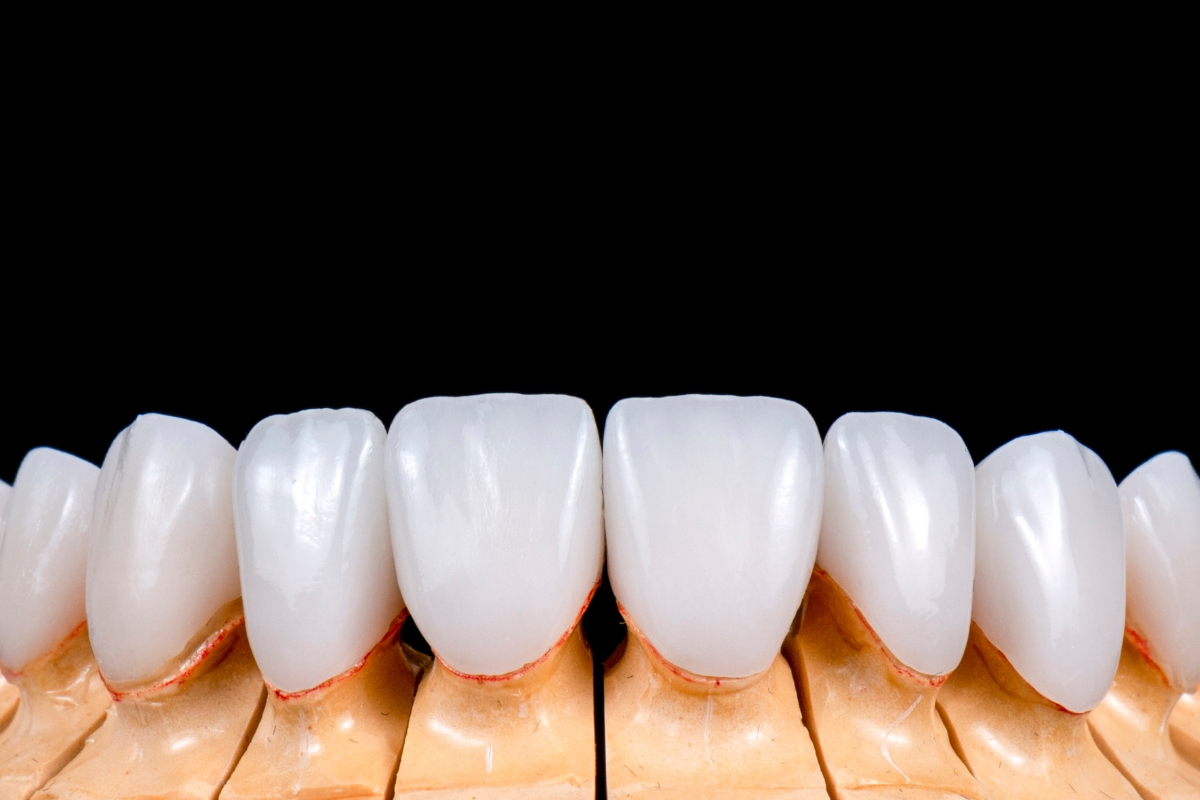 porcelain veneers in Falls Church