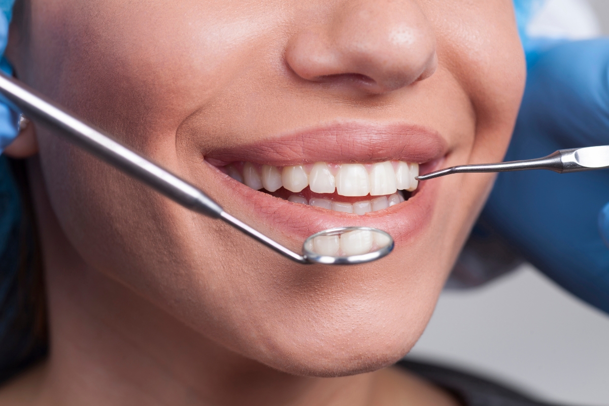 professional-teeth-whitening-in-Falls-Church